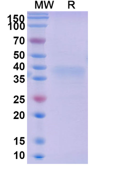 Recombinant Mouse LAYN/Layilin Protein, C-His
