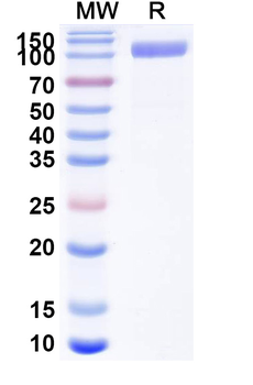 Recombinant Human CD22 Protein, C-His