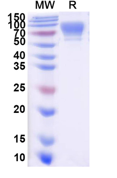 Recombinant Human CD6 Protein, C-His