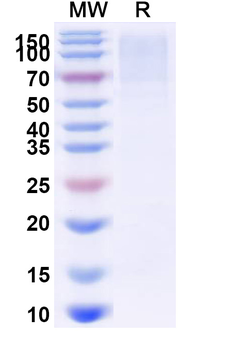 Recombinant EBV/HHV4 BLLF1/MA/GP350 Protein, C-His