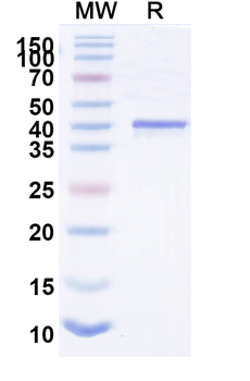 Recombinant Nipah virus/NiV M/Matrix Protein, N-His