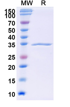 Recombinant Mouse COL17A1/Bp180 Protein, N-GST & C-His