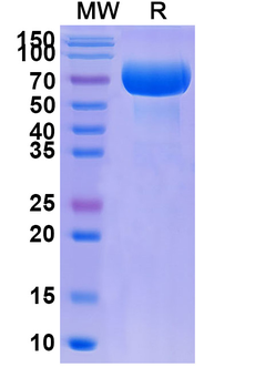 Recombinant Human CD200 Protein, C-Fc