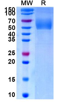 Recombinant Human CD334/FGFR4 Protein, C-His