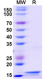 Recombinant Monkeypox virus/MPXV L1R Protein, N-His