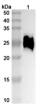 Recombinant Human CD147/BSG Protein, C-His