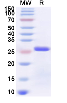 Recombinant Human CD140a/PDGFRA Protein, N-His