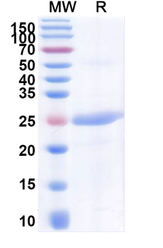 Recombinant Human CD319/SLAMF7 Protein, N-His
