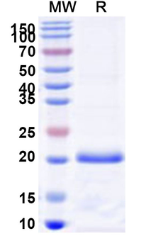 Recombinant Human PKN1 Protein, N-His