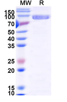 Recombinant Human MDM2 Protein, N-His