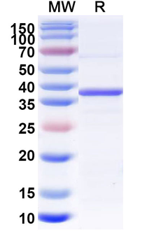 Recombinant Human WNT3A Protein, N-His