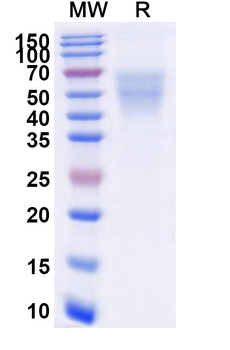 Recombinant Human CD86/B7-2 Protein, C-His