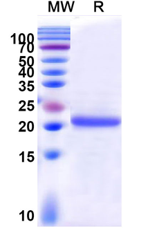 Recombinant Human CASP1/Caspase-1 Protein, N-His