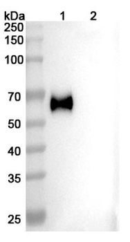 Recombinant Human CD333/FGFR3 Protein, C-His