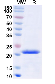 Recombinant Human CD224/GGT1 Protein, N-His