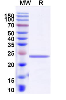 Recombinant Human COL6A3 Protein, N-His