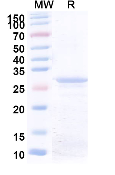 Recombinant Human COL6A1 Protein, N-His