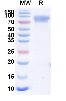 Recombinant Human CD117/KIT Protein, C-His