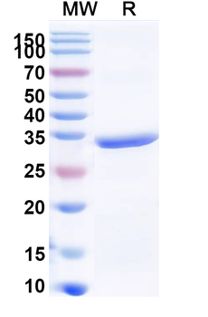 Recombinant Human COL1A2 Protein, N-His
