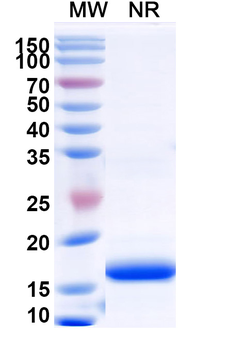 Recombinant Human BCHE Protein, N-His