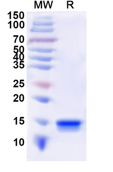 Recombinant Human CD3D Protein, N-His