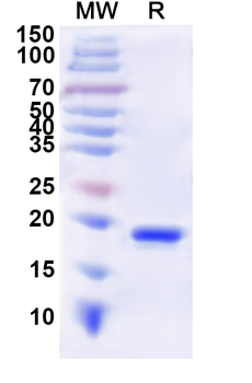 Recombinant Human CD8A Protein, N-His