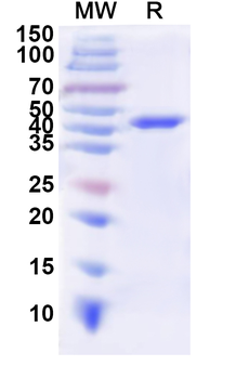 Recombinant Human a1AT/Serpin A1/SERPINA1 Protein, N-His