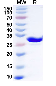 Recombinant Human CA2 Protein, N-His