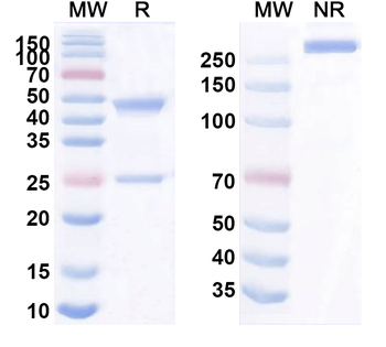 CCR5 Mouse Monoclonal Antibody