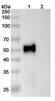 AMHR2/MISRII Mouse Monoclonal Antibody