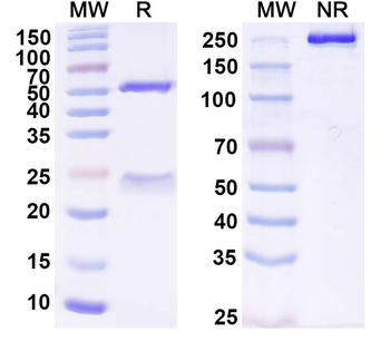 IgE/IGHE Mouse Monoclonal Antibody