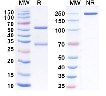 LPL/LIPD Mouse Recombinant Antibody