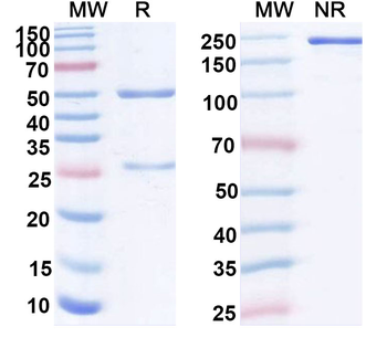 IL18/IL1F4 Human Monoclonal Antibody