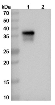 CLEC5A/MDL1 Human Monoclonal Antibody