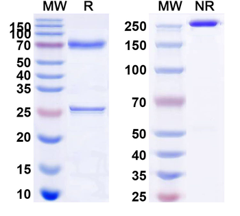 MUC16/CA125 Mouse Monoclonal Antibody