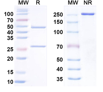 Orthohantavirus puumalaense GP Human Monoclonal Antibody