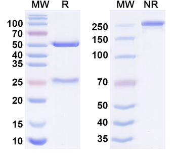 SARS-CoV-2 Spikeprotein (RBD) Human Monoclonal Antibody