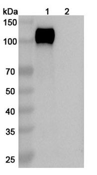 Rezetamig Human Monoclonal Antibody