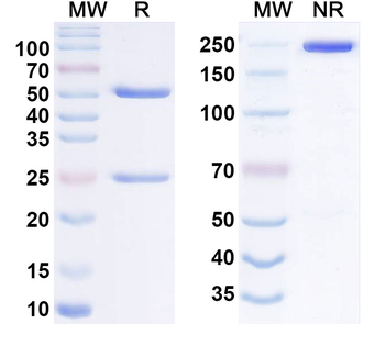IL31RA Human Monoclonal Antibody