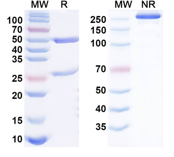 IL17A Human Monoclonal Antibody