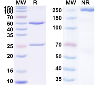 CD365/KIM-1/TIM-1/HAVCR1 Human Monoclonal Antibody