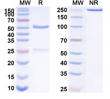 TGFB1/TGF-beta-1 Human Monoclonal Antibody