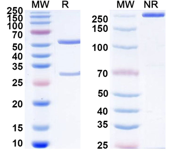 FOLH1/PSMA Human Monoclonal Antibody