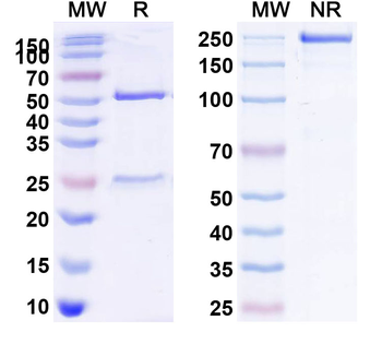 CD122/IL2RB Human Monoclonal Antibody