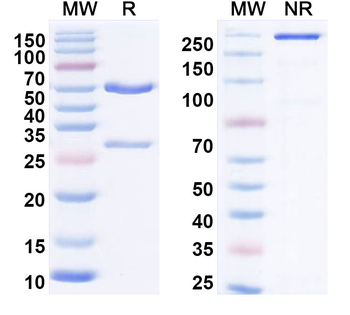 IL21 Human Monoclonal Antibody