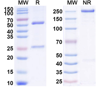 IL1B/IL1F2 Human Monoclonal Antibody