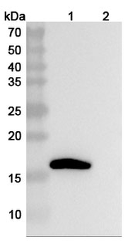 IL1B/IL1F2 Human Monoclonal Antibody