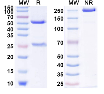 IL18/IL1F4 Human Monoclonal Antibody