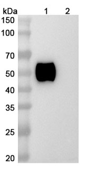 Epacmarstobart Human Monoclonal Antibody