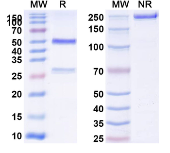 CD39/ENTPD1 Human Monoclonal Antibody